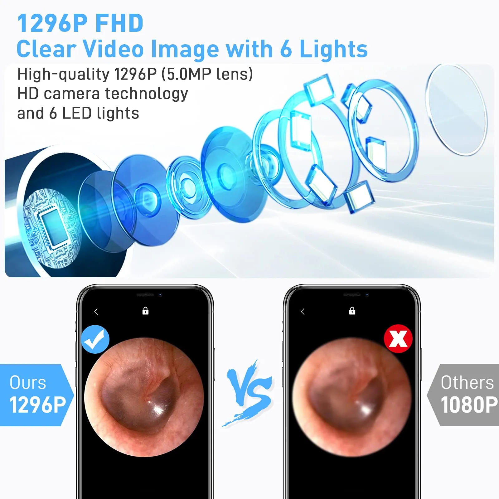 AWELOR Ear Wax Removal Ear Cleaner with Camera,1296P HD Endoscope Earwax Remover Tool with 6 LED Lights,Wireless Ear Otoscope Ear Cleaning Tool for iPhone, iPad & Android Smart Phones